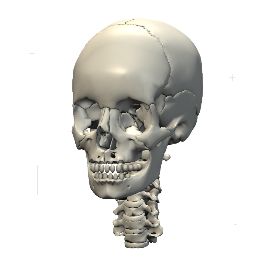 Head